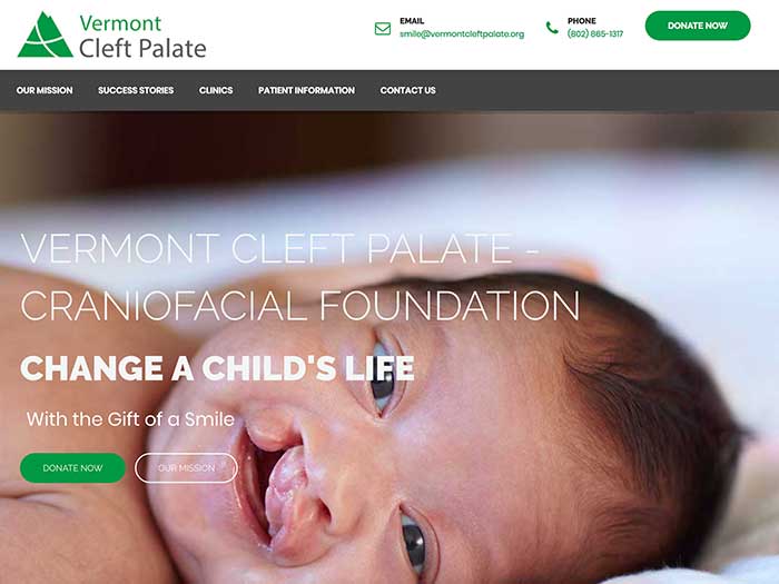 Vermont Cleft Palate